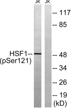 HSF1 (phospho Ser121) rabbit pAb Antibody