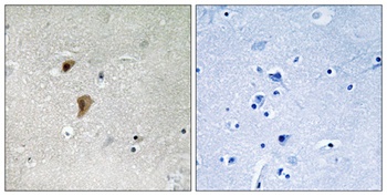 HSF1 (phospho Thr142) rabbit pAb Antibody