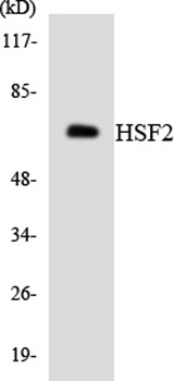 HSF2 rabbit pAb Antibody