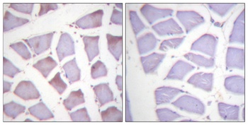 XIAP (phospho Ser87) rabbit pAb Antibody