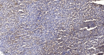 Survivin (phospho Thr34) rabbit pAb Antibody
