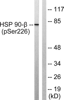 HSP90β (phospho Ser226) rabbit pAb Antibody