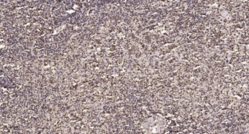 FoxN2 rabbit pAb Antibody