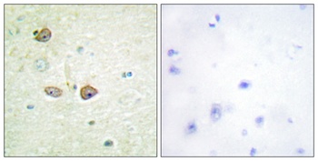 SR-1B rabbit pAb Antibody