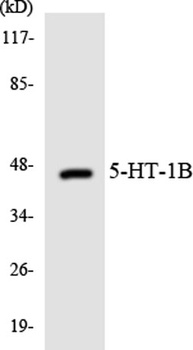 SR-1B rabbit pAb Antibody