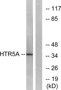 SR-5A rabbit pAb Antibody