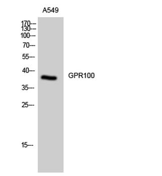 GPR100 rabbit pAb Antibody