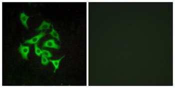 GPR100 rabbit pAb Antibody