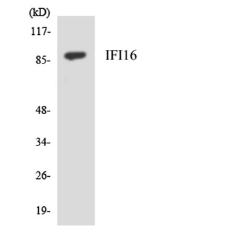 IFI-16 rabbit pAb Antibody