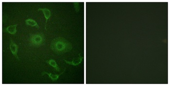 IFN-α/βRα rabbit pAb Antibody