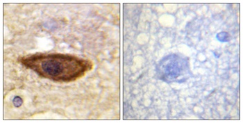 IFN-α/βRα rabbit pAb Antibody