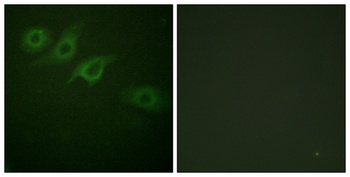 IFN-γRα rabbit pAb Antibody