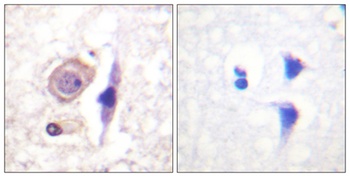 IFN-γRα rabbit pAb Antibody