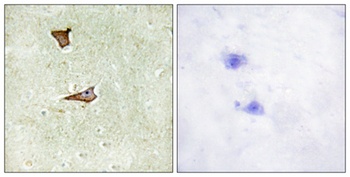 IGF-IIR (phospho Ser2409) rabbit pAb Antibody
