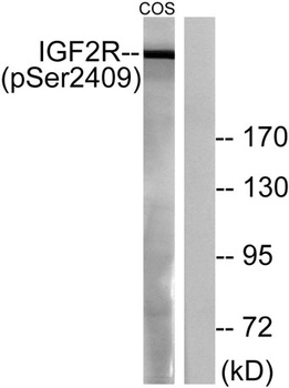 IGF-IIR (phospho Ser2409) rabbit pAb Antibody