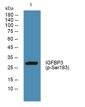 IGFBP3 (phospho Ser183) rabbit pAb Antibody