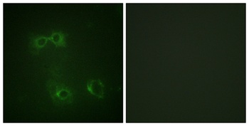 FAS (phospho Tyr291) rabbit pAb Antibody