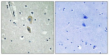 IL-1RI (phospho Tyr496) rabbit pAb Antibody