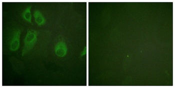 IL-2Rα rabbit pAb Antibody