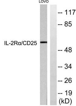 IL-2Rα rabbit pAb Antibody