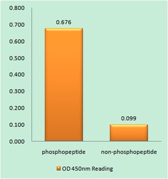 IL-2Rβ (phospho Tyr364) rabbit pAb Antibody