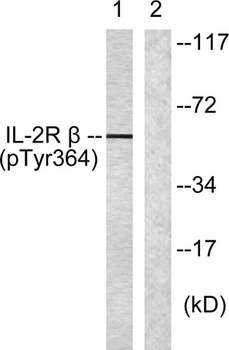 IL-2Rβ (phospho Tyr364) rabbit pAb Antibody