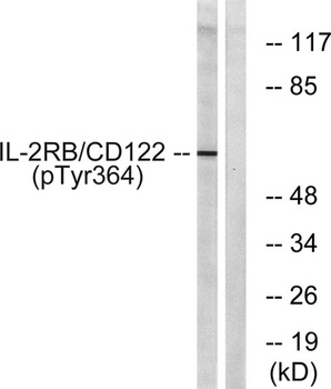 IL-2Rβ (phospho Tyr364) rabbit pAb Antibody