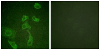 IL-2Rβ rabbit pAb Antibody