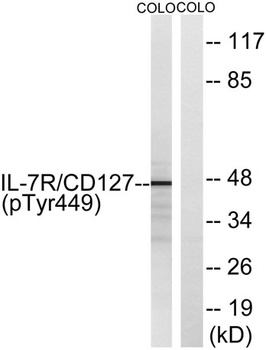 IL-7R (phospho Tyr449) rabbit pAb Antibody