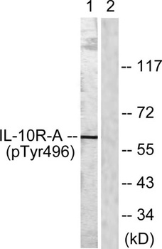 IL-10Rα (phospho Tyr496) rabbit pAb Antibody