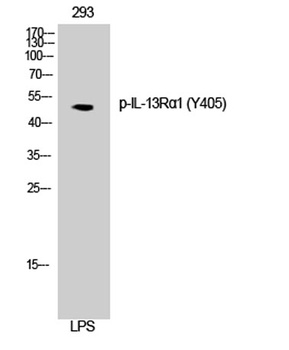 IL-13Rα1 (phospho Tyr405) rabbit pAb Antibody