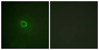IL-13Rα1 (phospho Tyr405) rabbit pAb Antibody