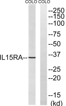 IL-15Rα rabbit pAb Antibody