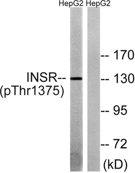 Insulin R (phospho Thr1375) rabbit pAb Antibody