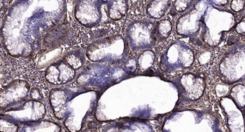 Insulin R (phospho Thr1375) rabbit pAb Antibody