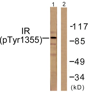 Insulin R (phospho Tyr1355) rabbit pAb Antibody