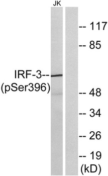 IRF-3 (phospho Ser396) rabbit pAb Antibody