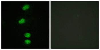 AR (phospho Ser94) rabbit pAb Antibody