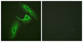 Integrin β2 rabbit pAb Antibody