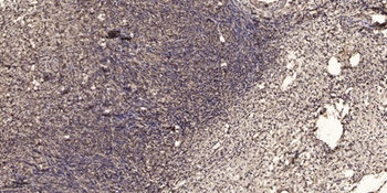 Integrin β2 rabbit pAb Antibody