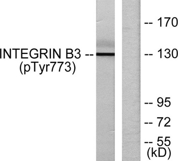 Integrin β3 (phospho Tyr773) rabbit pAb Antibody