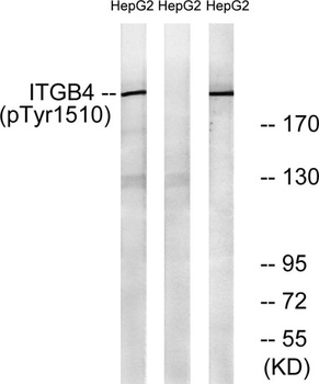 Integrin β4 (phospho Tyr1510) rabbit pAb Antibody
