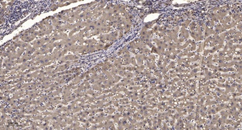 ITPK1 rabbit pAb Antibody