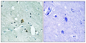 IP3R-I (phospho Ser1764) rabbit pAb Antibody