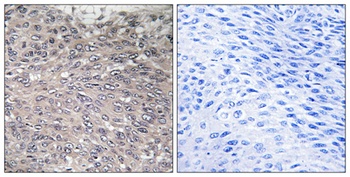 IP3R-I (phospho Ser1598) rabbit pAb Antibody