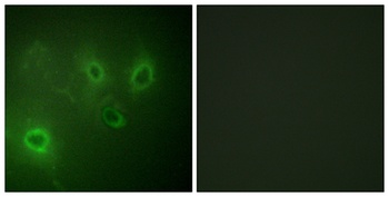 IP3R-I rabbit pAb Antibody