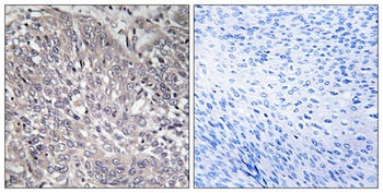 IP3R-I rabbit pAb Antibody