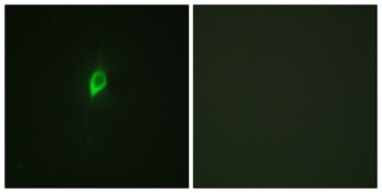 eIF4B (phospho Ser422) rabbit pAb Antibody