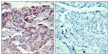 JAK2 (phospho Tyr221) rabbit pAb Antibody