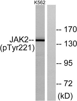 JAK2 (phospho Tyr221) rabbit pAb Antibody